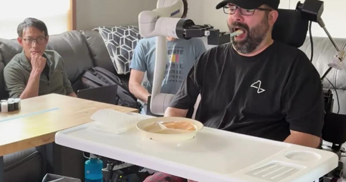 馬斯克預告：Neuralink 腦機介面裝置將於 2026 年量產，手術流程走向全自動化