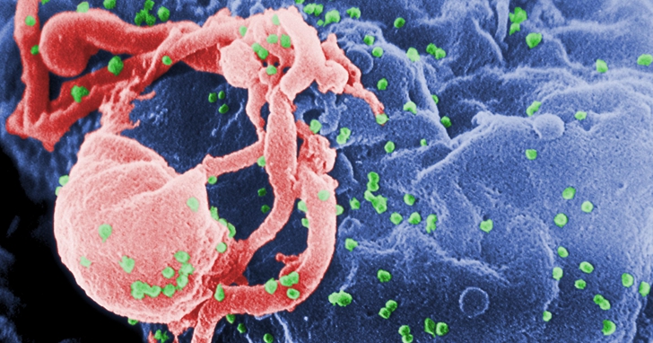 愛滋病有望治癒？法國科學家成功摧毀感染HIV病毒細胞