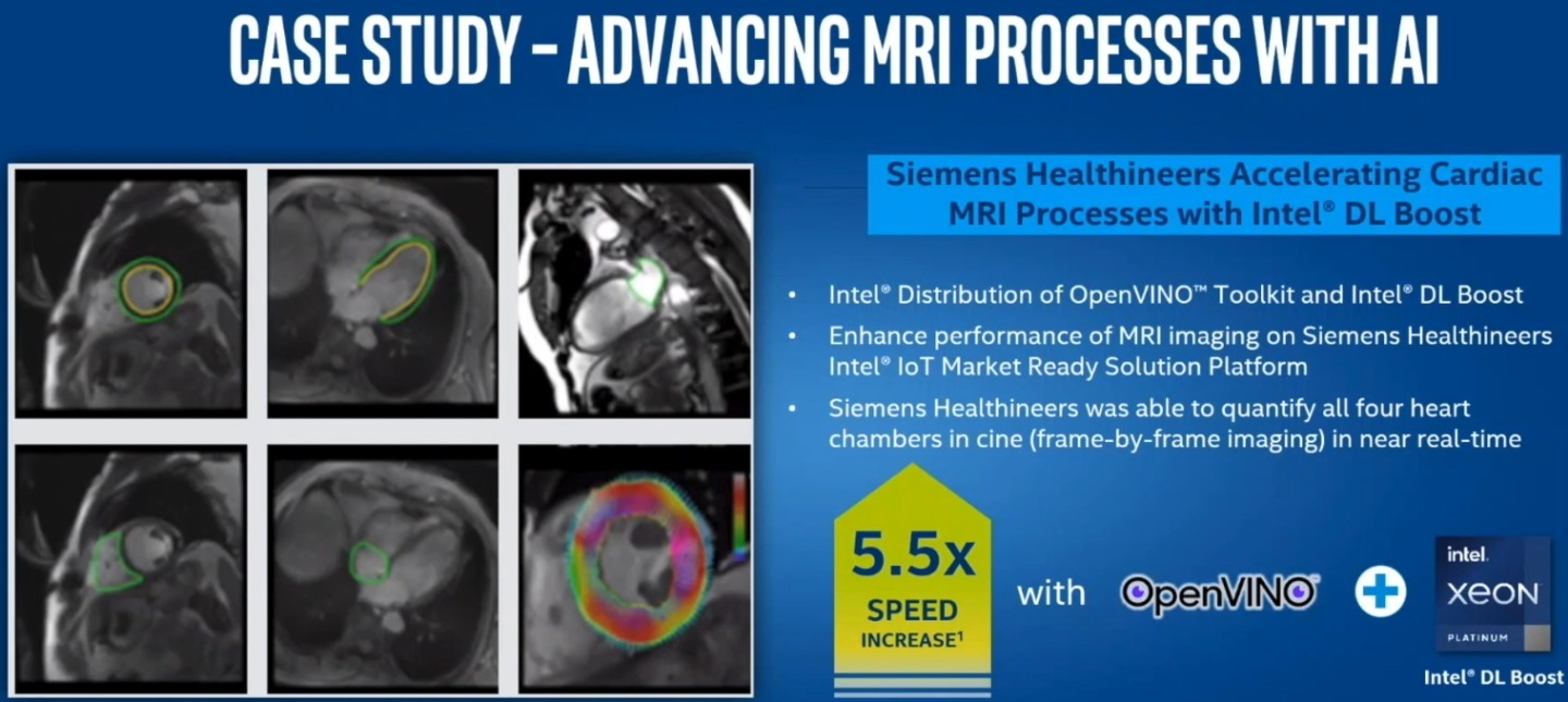 Intel DL Boost與OpenVINO技術能將核磁共振心臟檢查的速度提升至5倍以上。