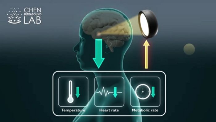 科家用超音波刺激動物大腦讓其實現冬眠，未來可用於太空旅行